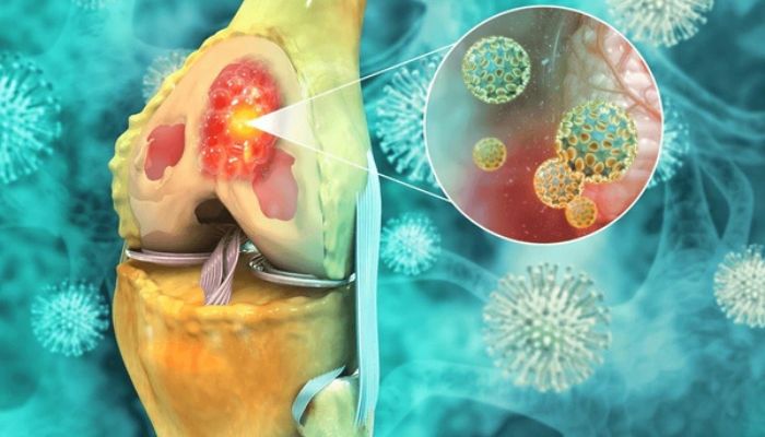 Bone and Soft Tissue Tumor Treatment in Jodhpur, Rajasthan by Dr. Virendra Rajpurohit, leading Cancer specialist