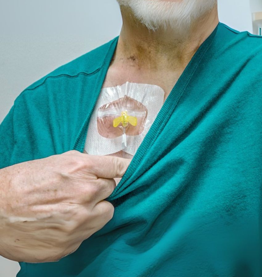 Central Line / Chemoport Insertion and Management in Jodhpur, Rajasthan by Dr. Virendra Rajpurohit, leading Cancer specialist